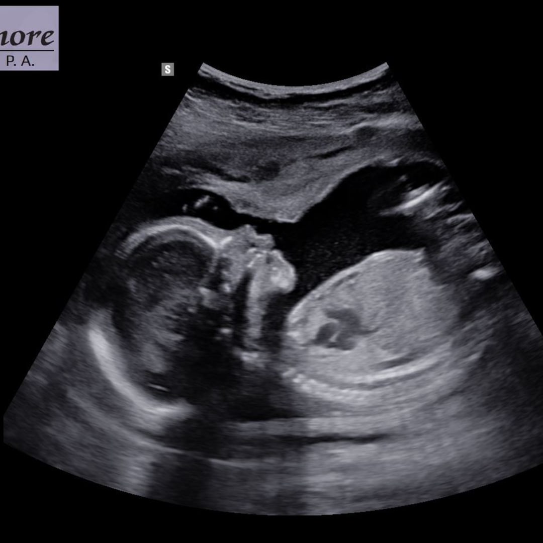 Photo shared by Katherine (Kate) for their Babylist baby registry.