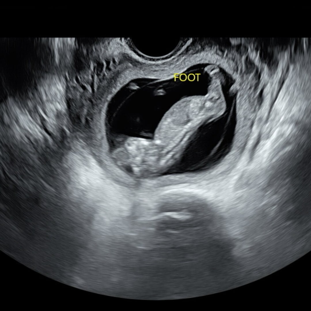 Photo shared by Hannah for their Babylist baby registry.