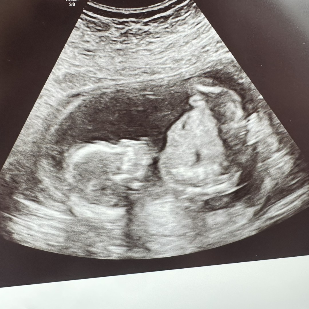 Photo shared by Hailey for their Babylist baby registry.