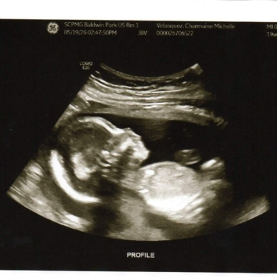 Photo shared by Charmaine Michelle for their Babylist baby registry.