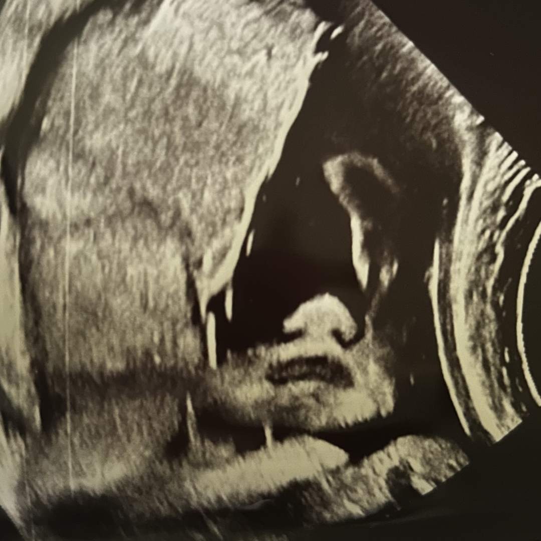 Photo shared by Isabella for their Babylist baby registry.
