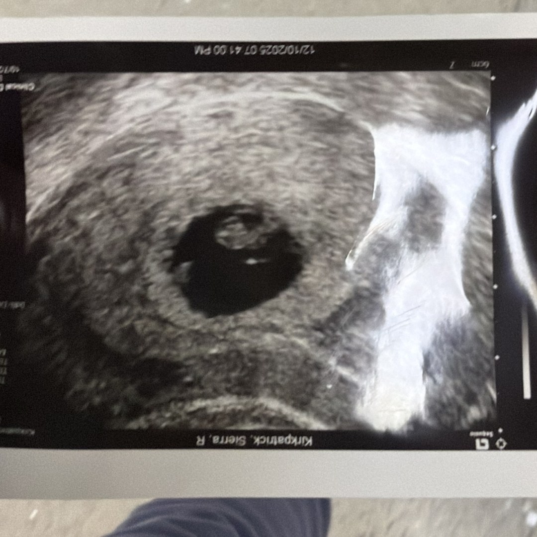 Photo shared by Sierra for their Babylist baby registry.