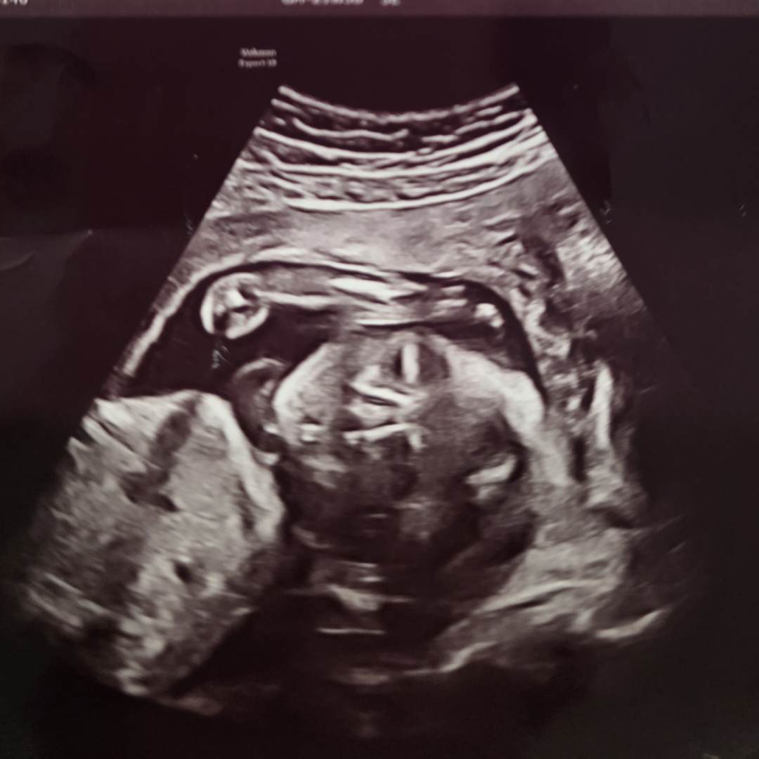 Photo shared by Jessie for their Babylist baby registry.