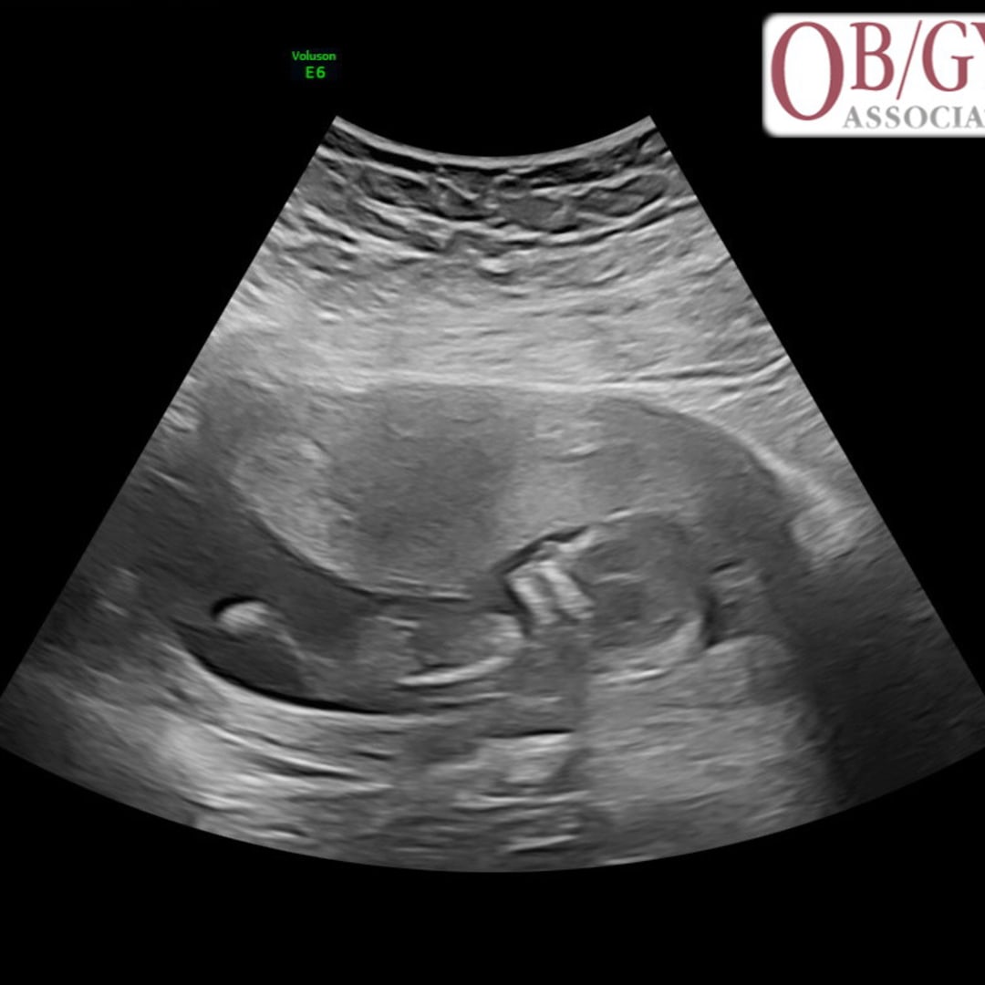 Photo shared by Macy for their Babylist baby registry.