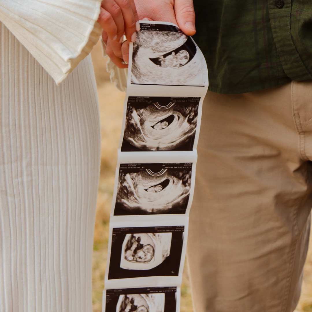 Photo shared by Lauren for their Babylist baby registry.