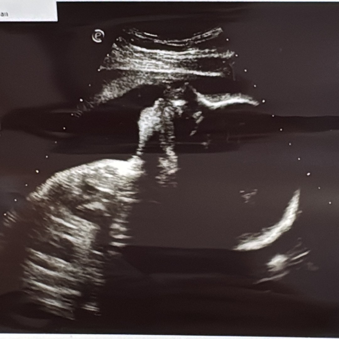 Photo shared by Joseline for their Babylist baby registry.