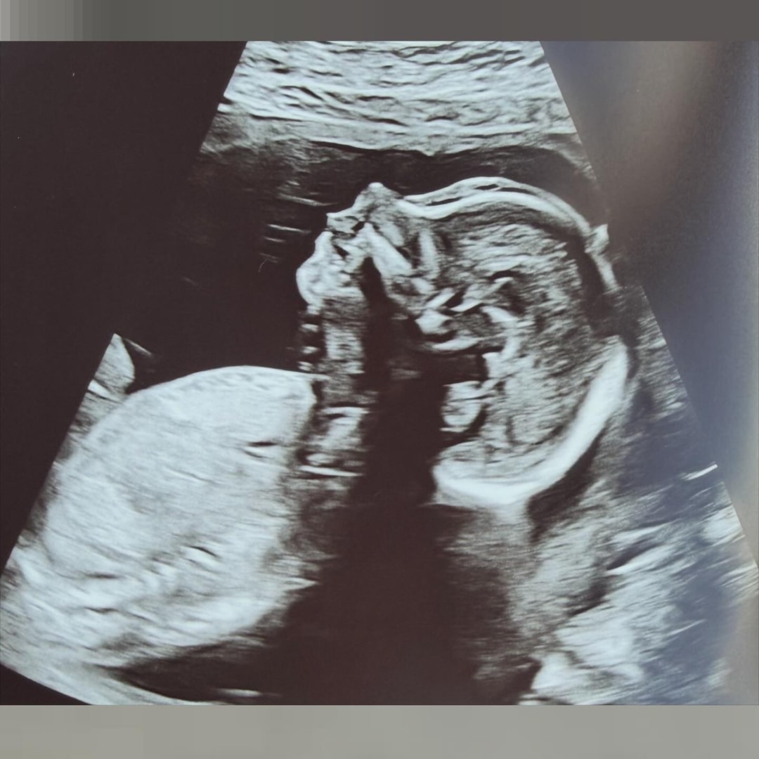 Photo shared by Caroline for their Babylist baby registry.