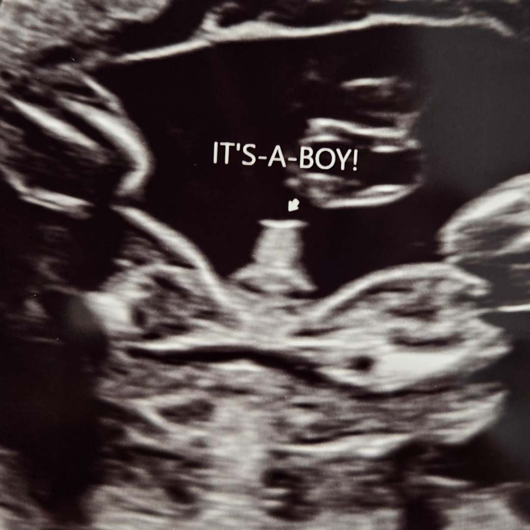 Photo shared by Brian for their Babylist baby registry.