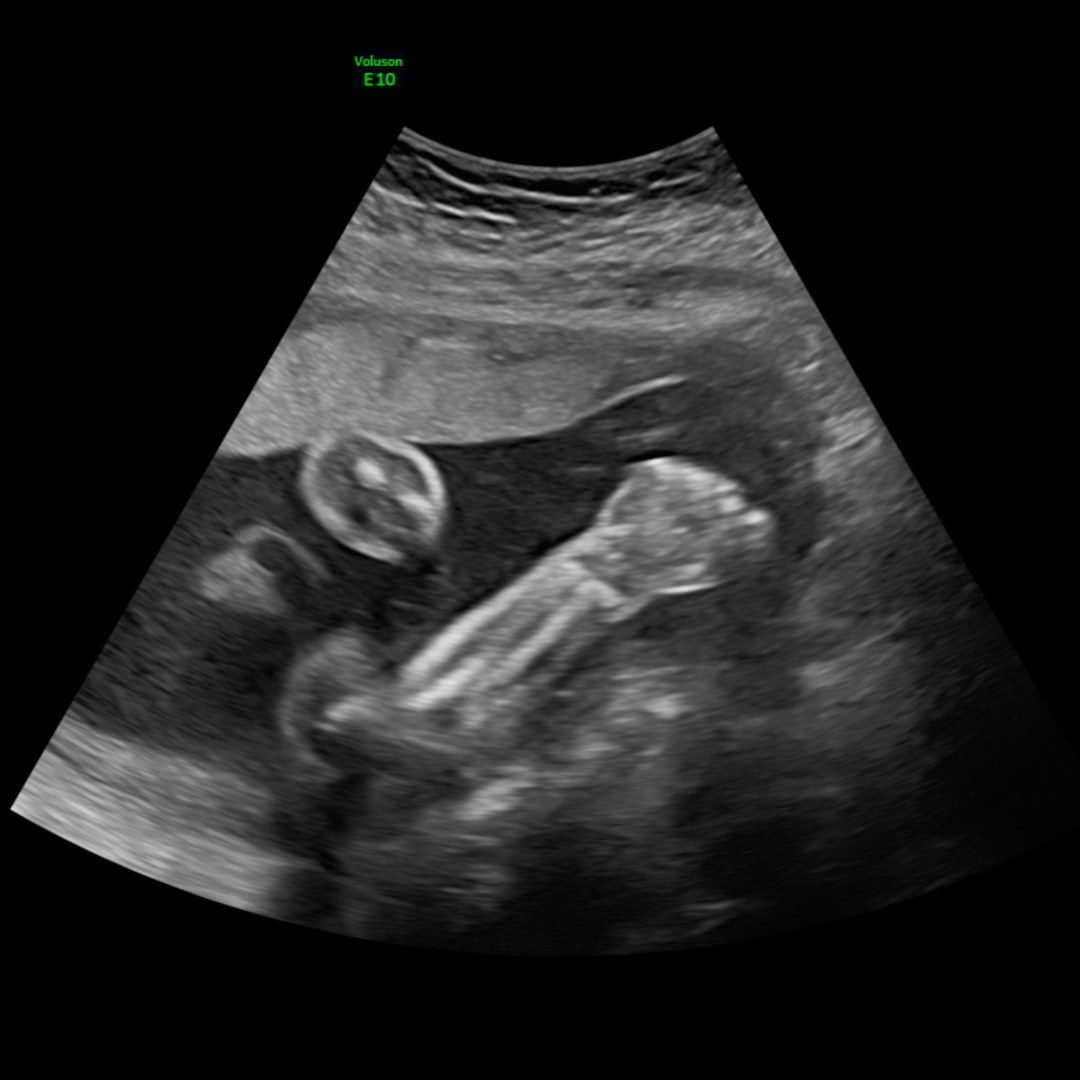 Photo shared by Ashley-Rachel for their Babylist baby registry.