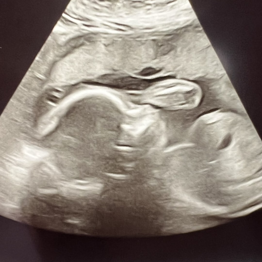 Photo shared by Victoria for their Babylist baby registry.