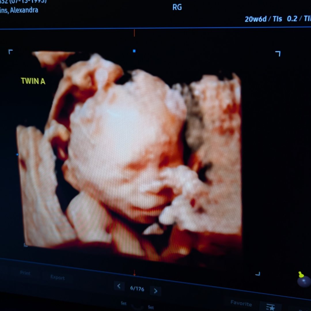 Photo shared by Alexandra for their Babylist baby registry.