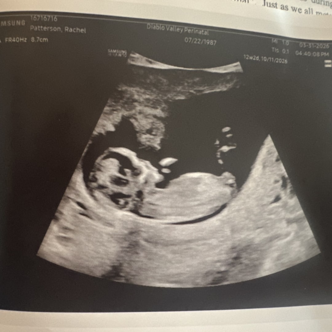 Photo shared by Rachel for their Babylist baby registry.