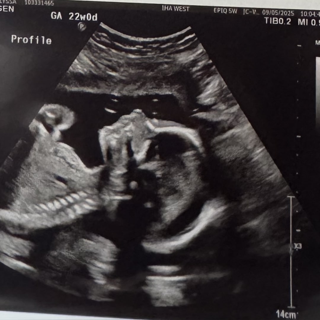 Photo shared by Alyssa for their Babylist baby registry.