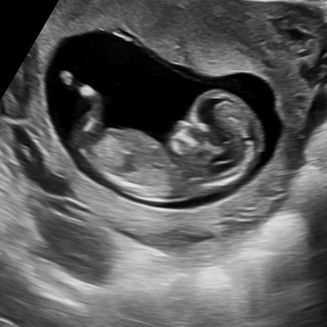 Photo shared by Radhika for their Babylist baby registry.