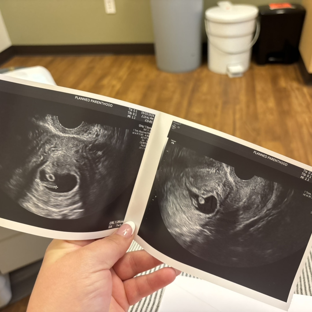 Photo shared by Tilly for their Babylist baby registry.