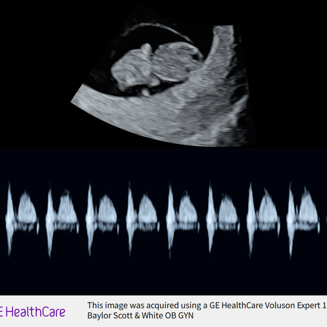 Photo shared by Claudia for their Babylist baby registry.