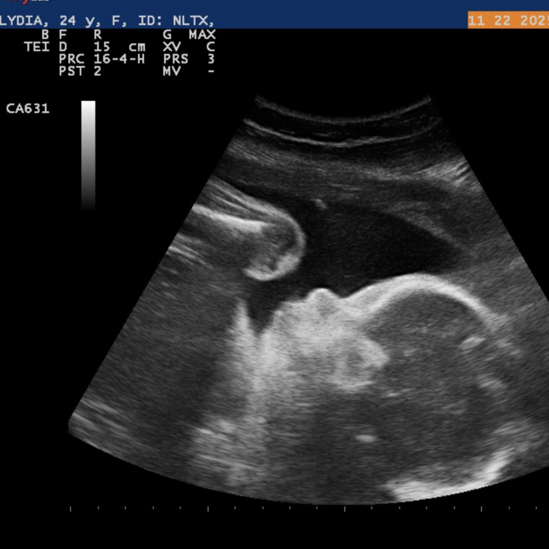 Photo shared by Lydia for their Babylist baby registry.