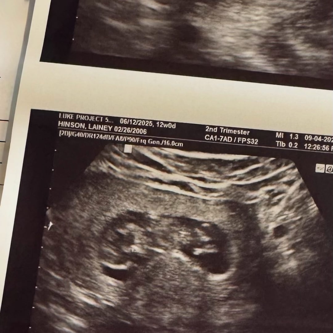 Photo shared by Lainey for their Babylist baby registry.