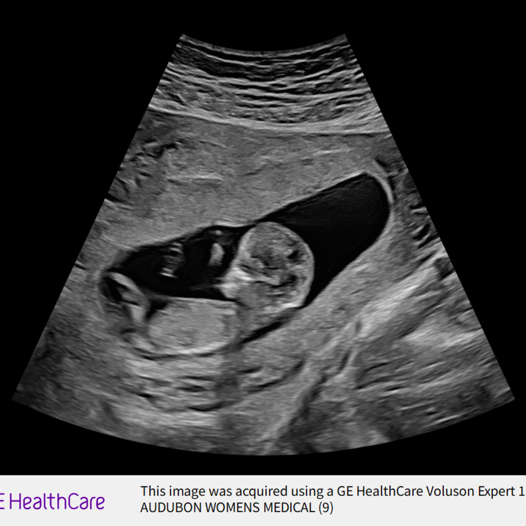 Photo shared by Amy for their Babylist baby registry.