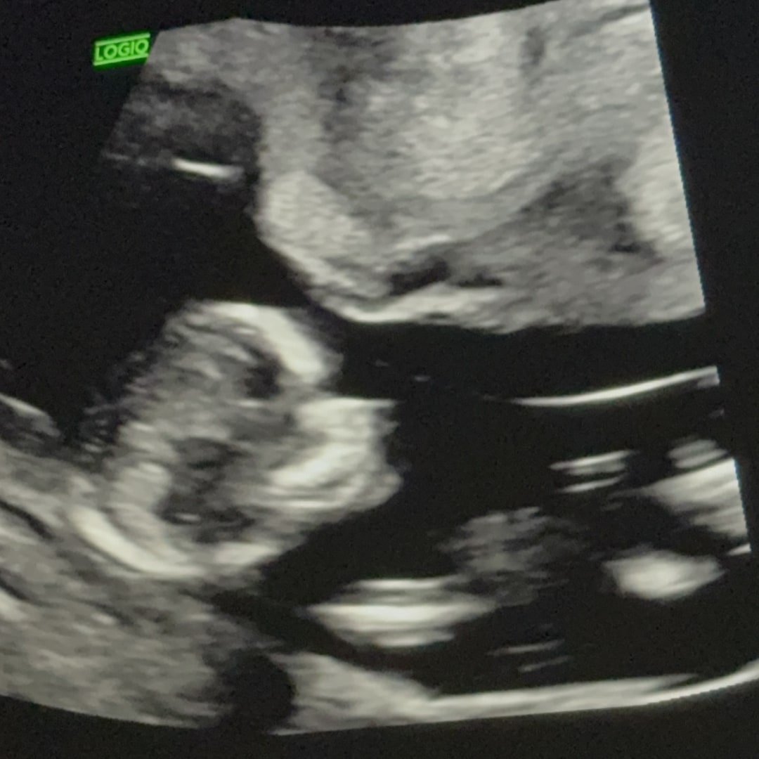 Photo shared by Shaley for their Babylist baby registry.