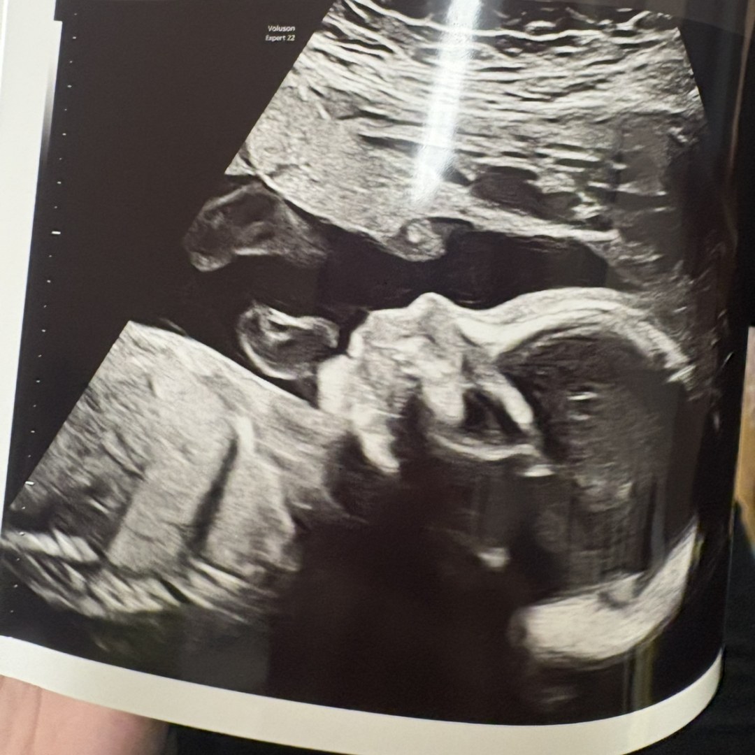 Photo shared by Anne for their Babylist baby registry.