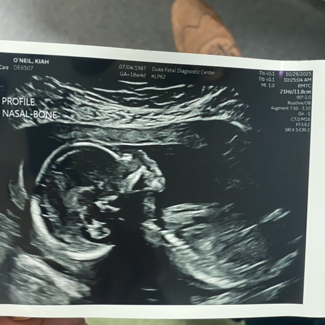 Photo shared by Maggie for their Babylist baby registry.