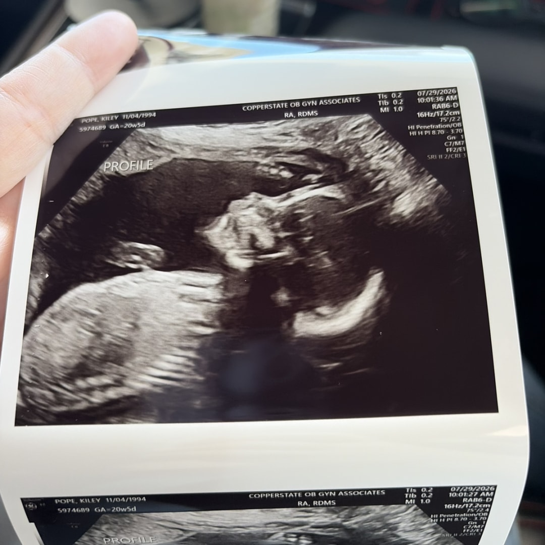 Photo shared by Kiley for their Babylist baby registry.