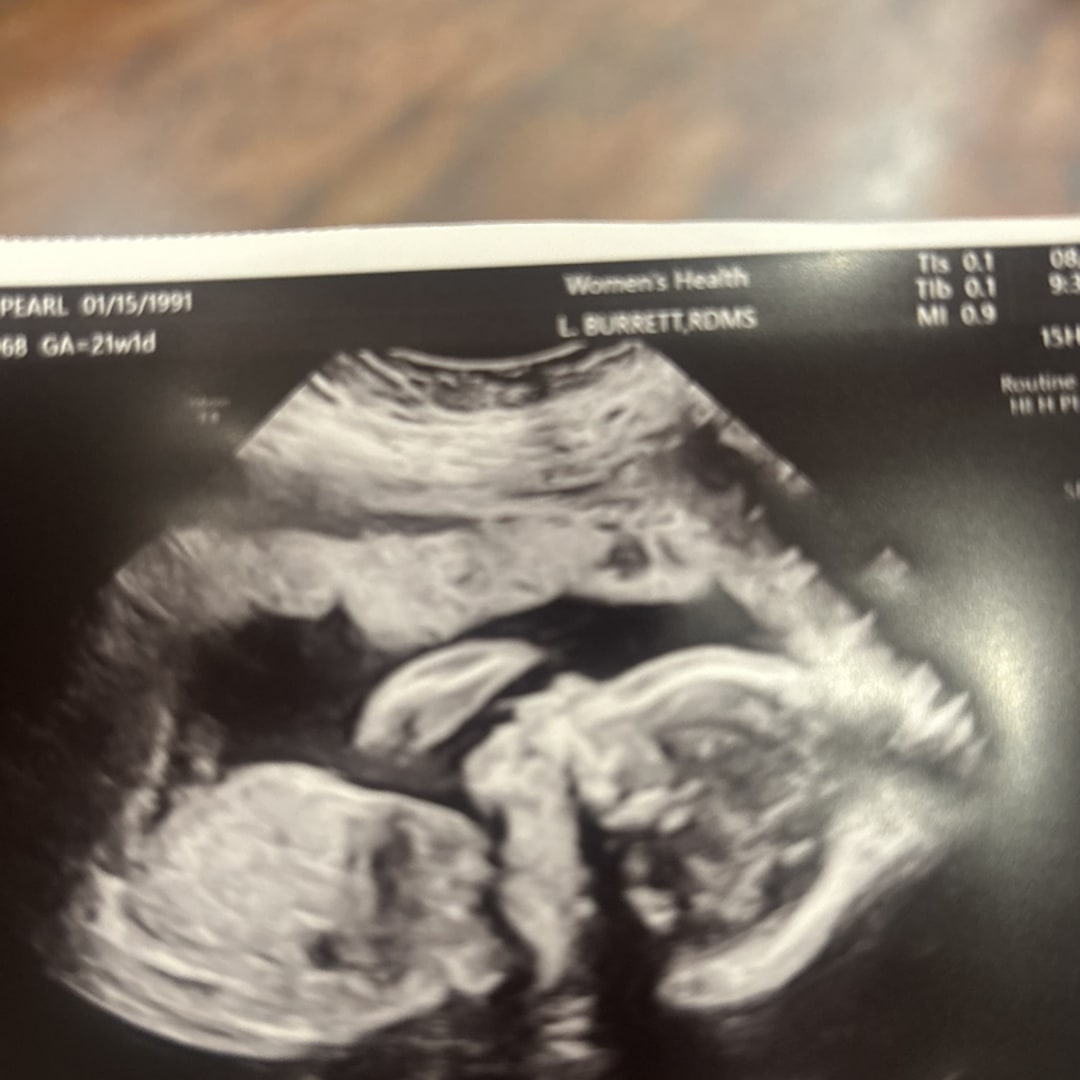 Photo shared by Pearl for their Babylist baby registry.