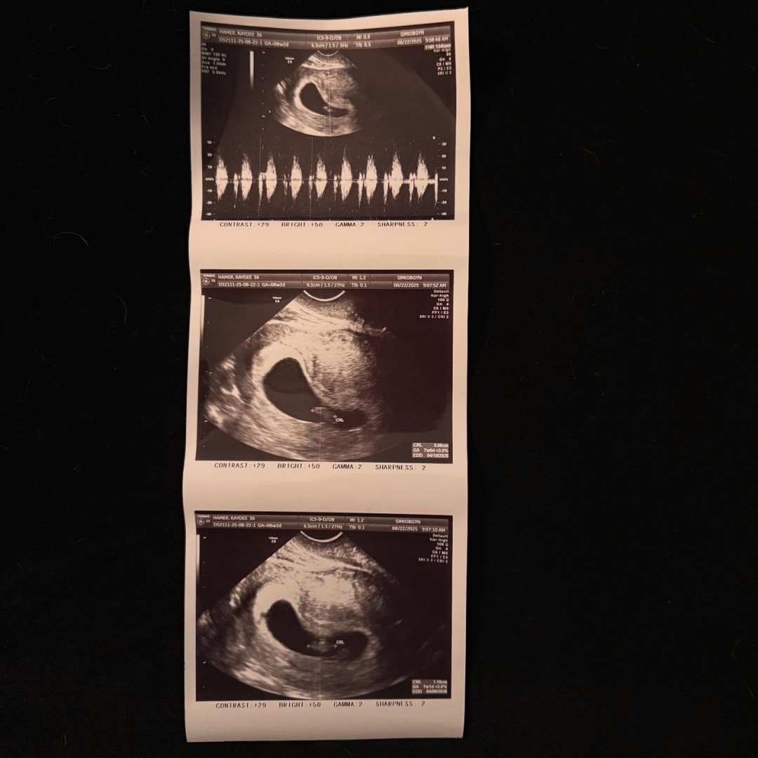 Photo shared by Kaydee for their Babylist baby registry.