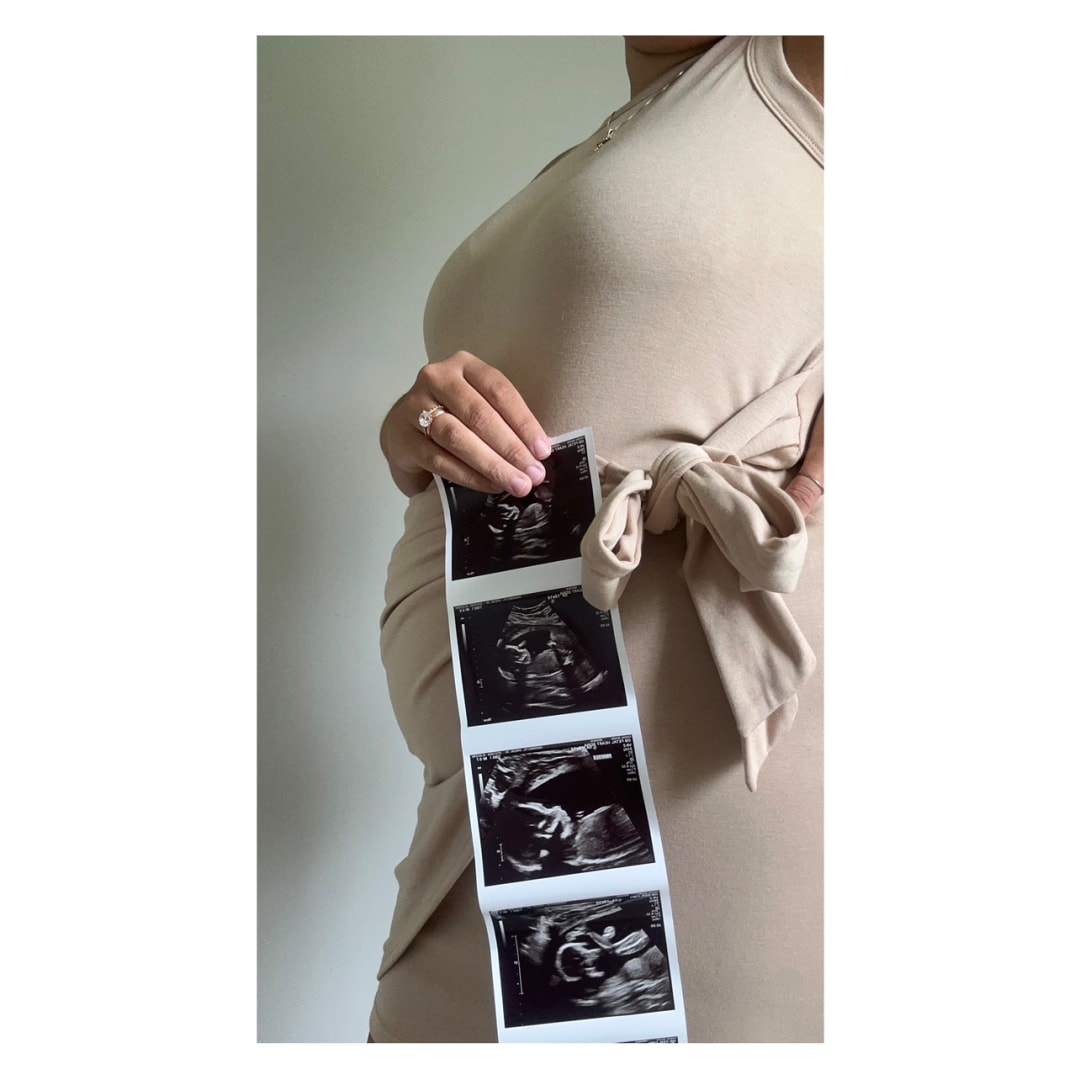 Photo shared by Emily for their Babylist baby registry.