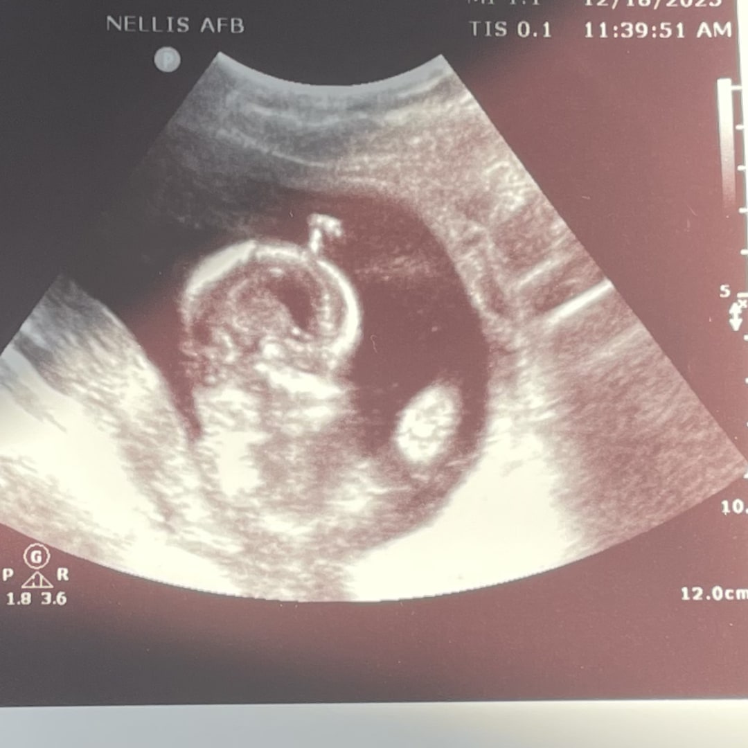 Photo shared by Alexis for their Babylist baby registry.