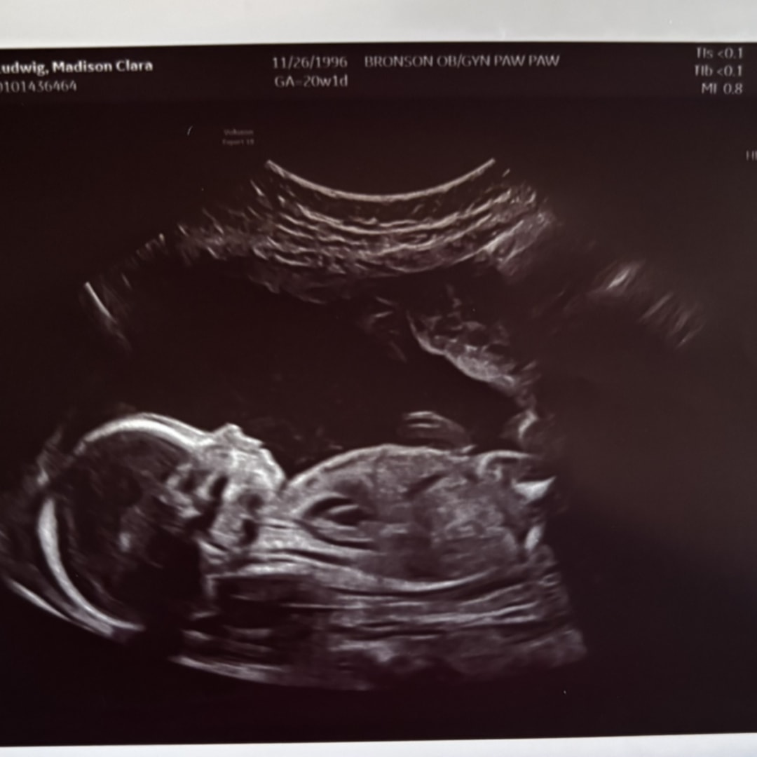 Photo shared by Madison for their Babylist baby registry.