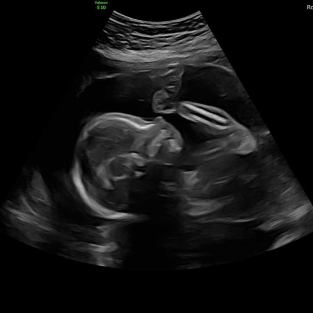 Photo shared by Lily for their Babylist baby registry.