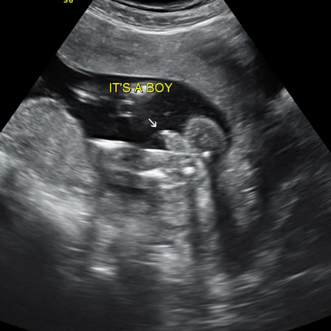Photo shared by Amanda for their Babylist baby registry.