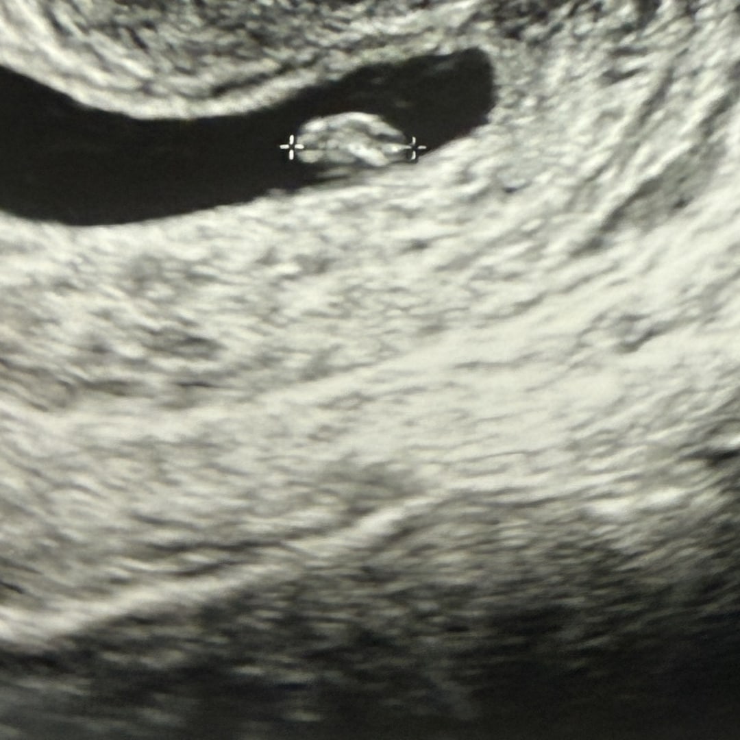 Photo shared by Addison for their Babylist baby registry.