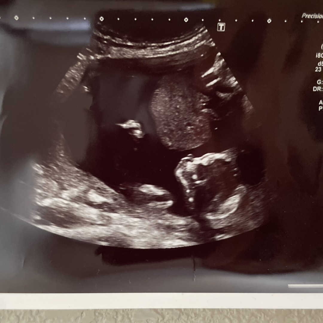 Photo shared by Amy for their Babylist baby registry.