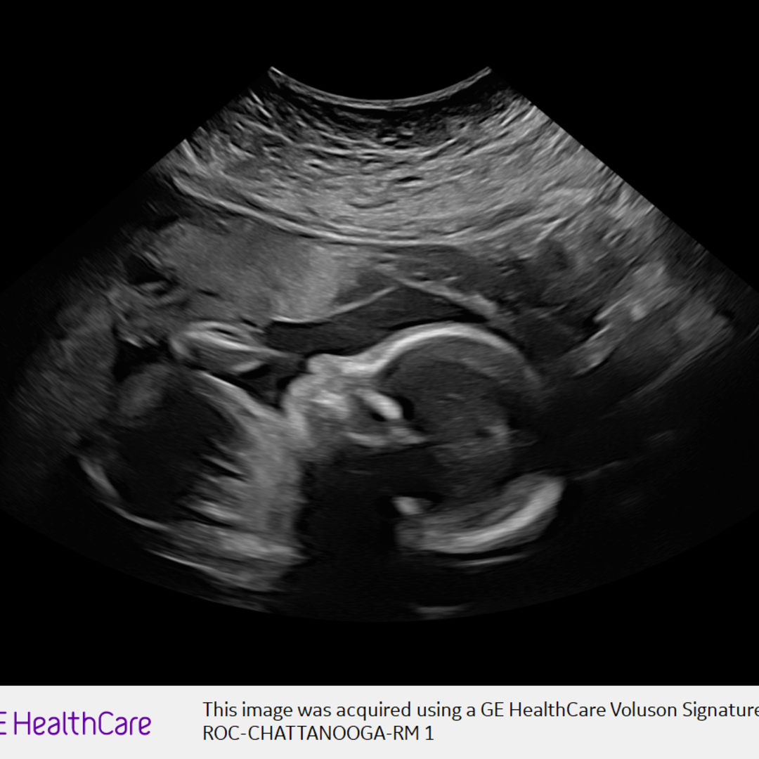 Photo shared by Alejandra for their Babylist baby registry.