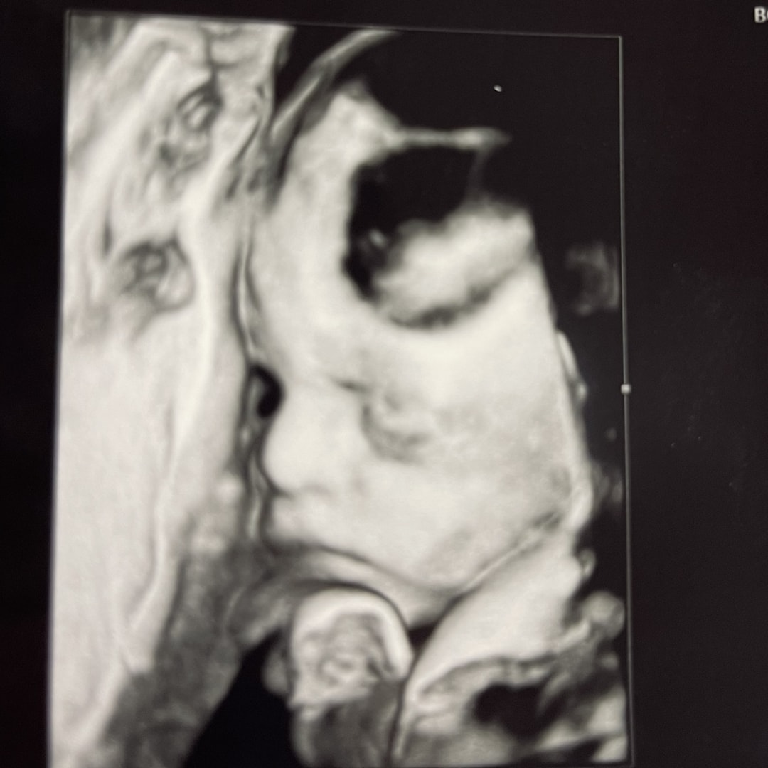Photo shared by Desirea for their Babylist baby registry.
