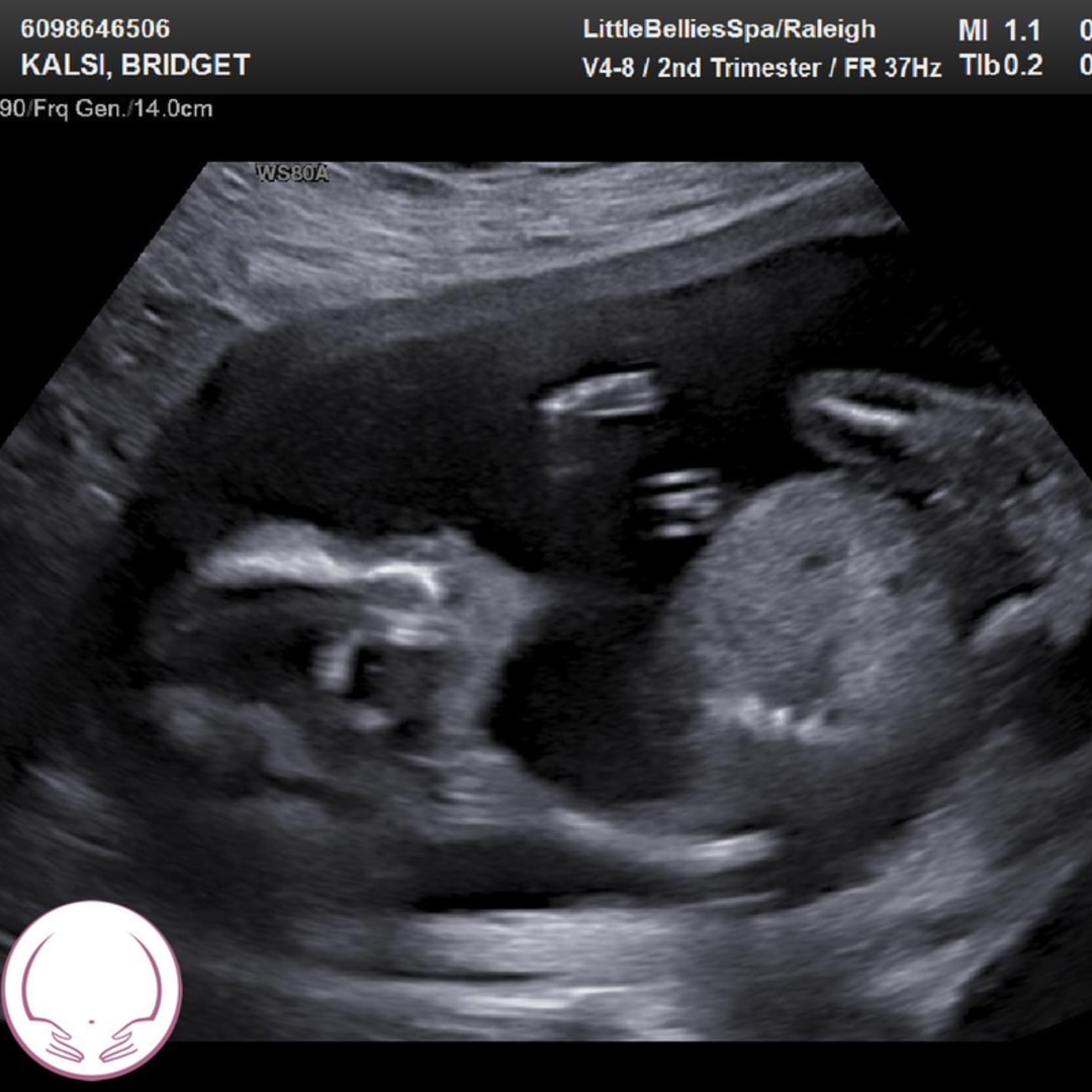 Photo shared by Bridget for their Babylist baby registry.