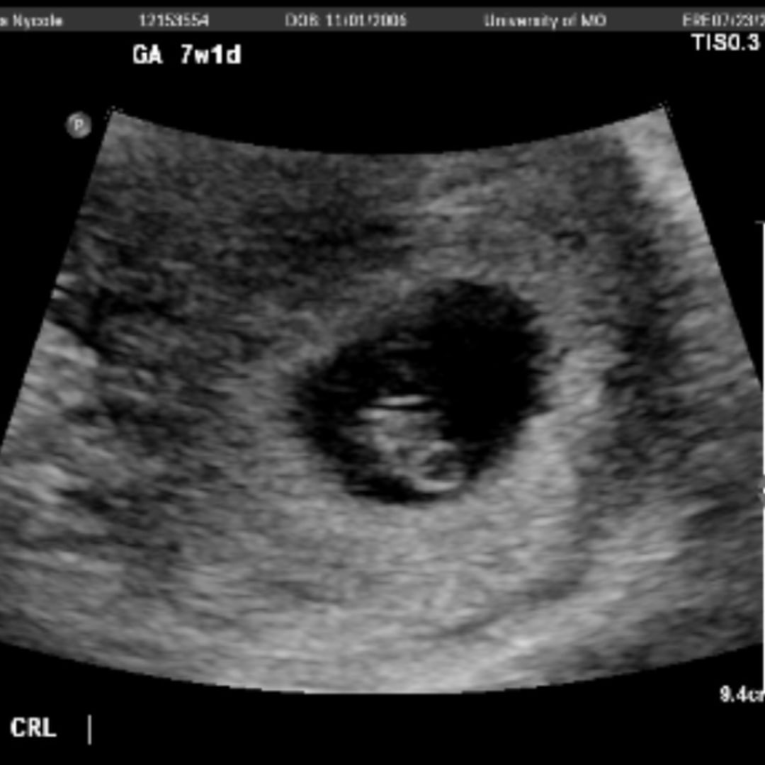 Photo shared by Makayla for their Babylist baby registry.
