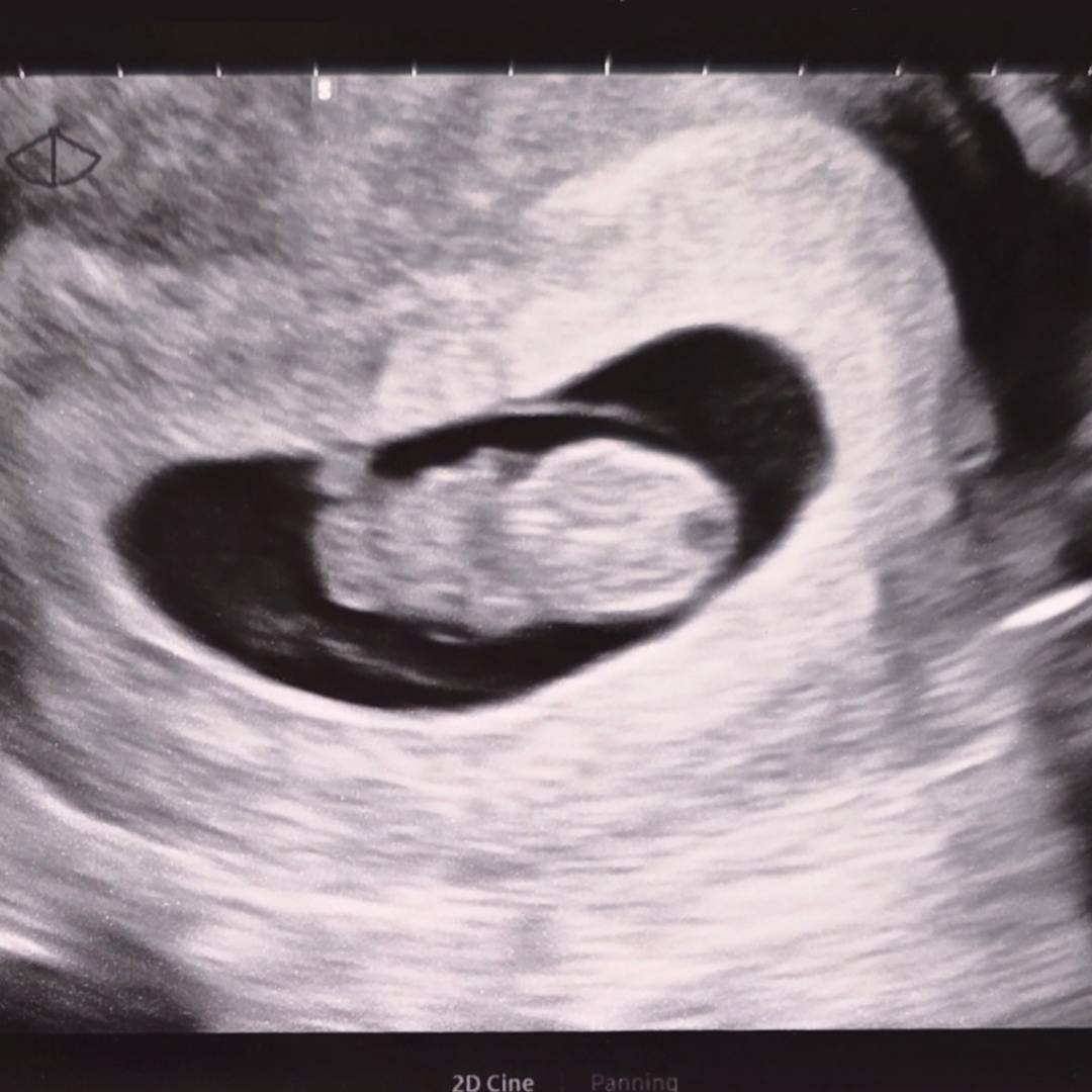Photo shared by Morgan for their Babylist baby registry.