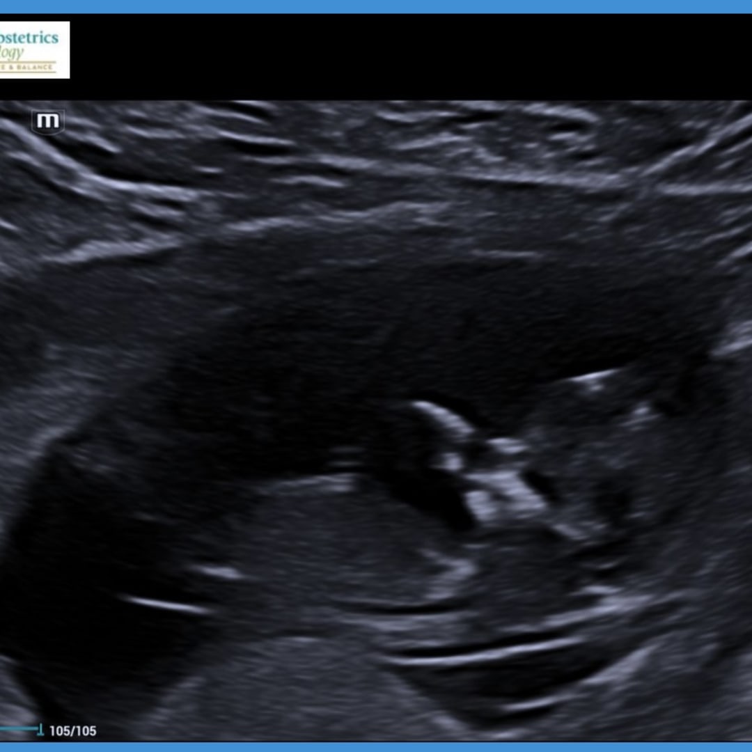 Photo shared by Harlee for their Babylist baby registry.