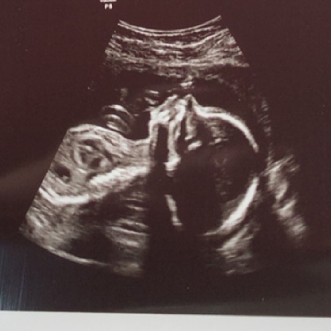 Photo shared by Caitlyn for their Babylist baby registry.