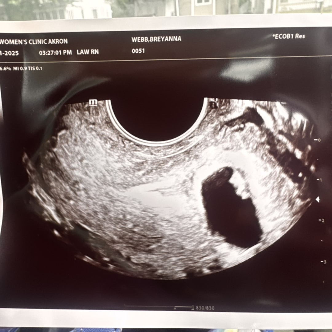 Photo shared by Breyanna for their Babylist baby registry.