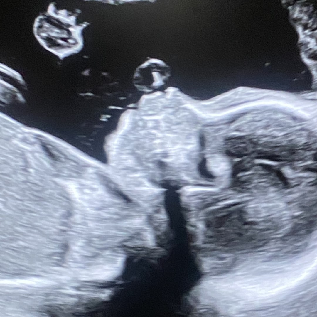 Photo shared by Liana for their Babylist baby registry.