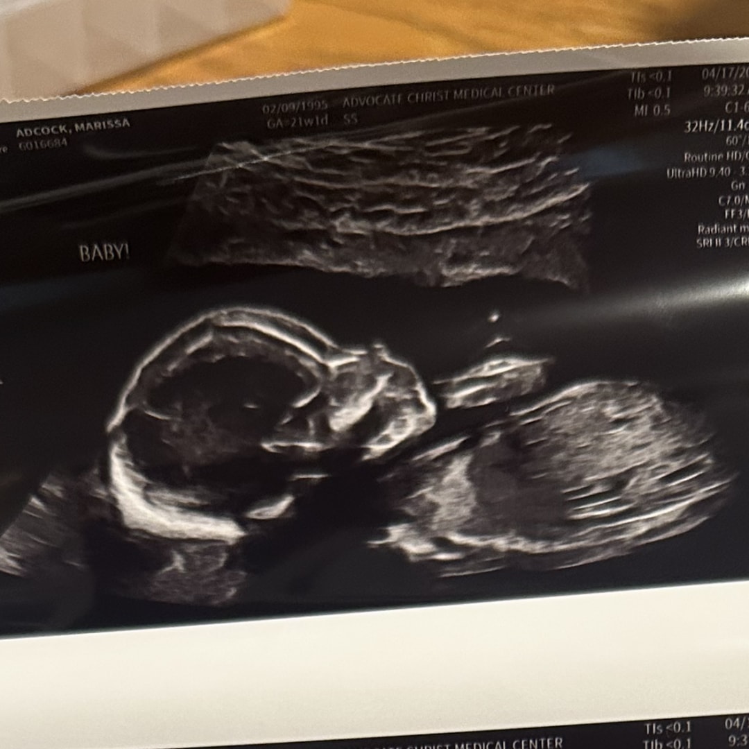 Photo shared by Marissa for their Babylist baby registry.