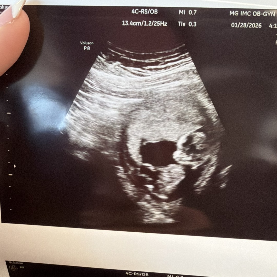 Photo shared by Anarely for their Babylist baby registry.