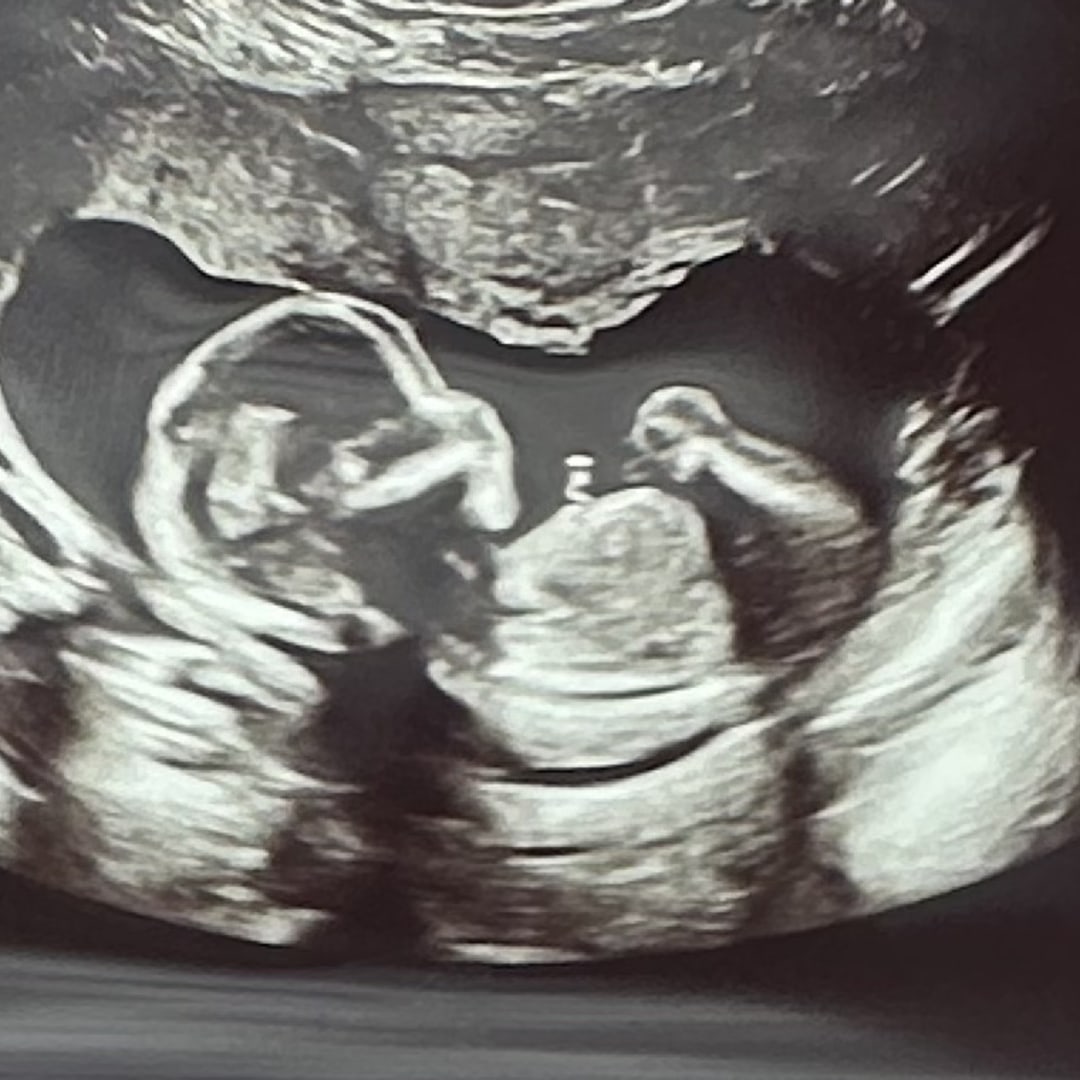 Photo shared by Amanda for their Babylist baby registry.