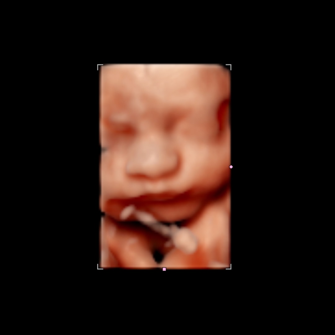 Photo shared by Alexa for their Babylist baby registry.