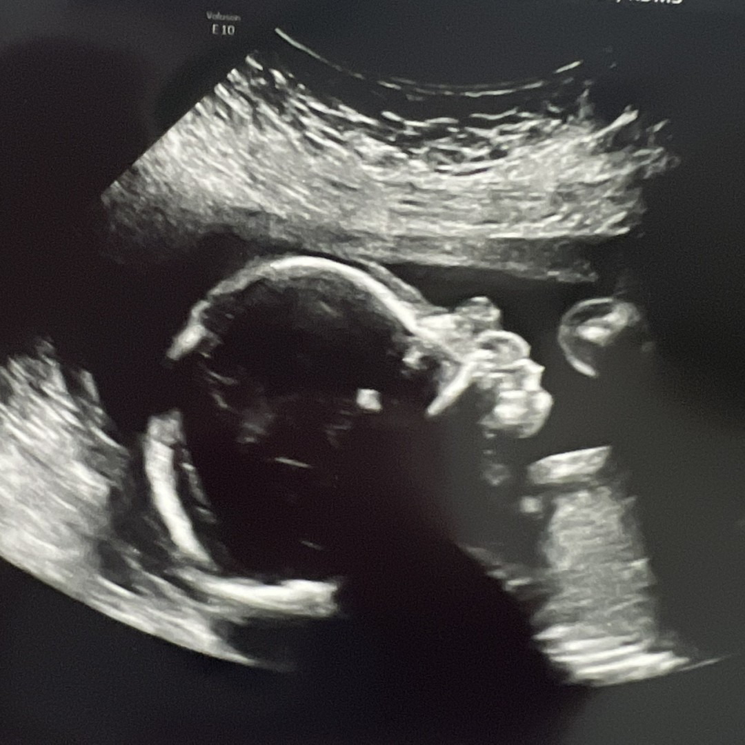 Photo shared by Jenna for their Babylist baby registry.